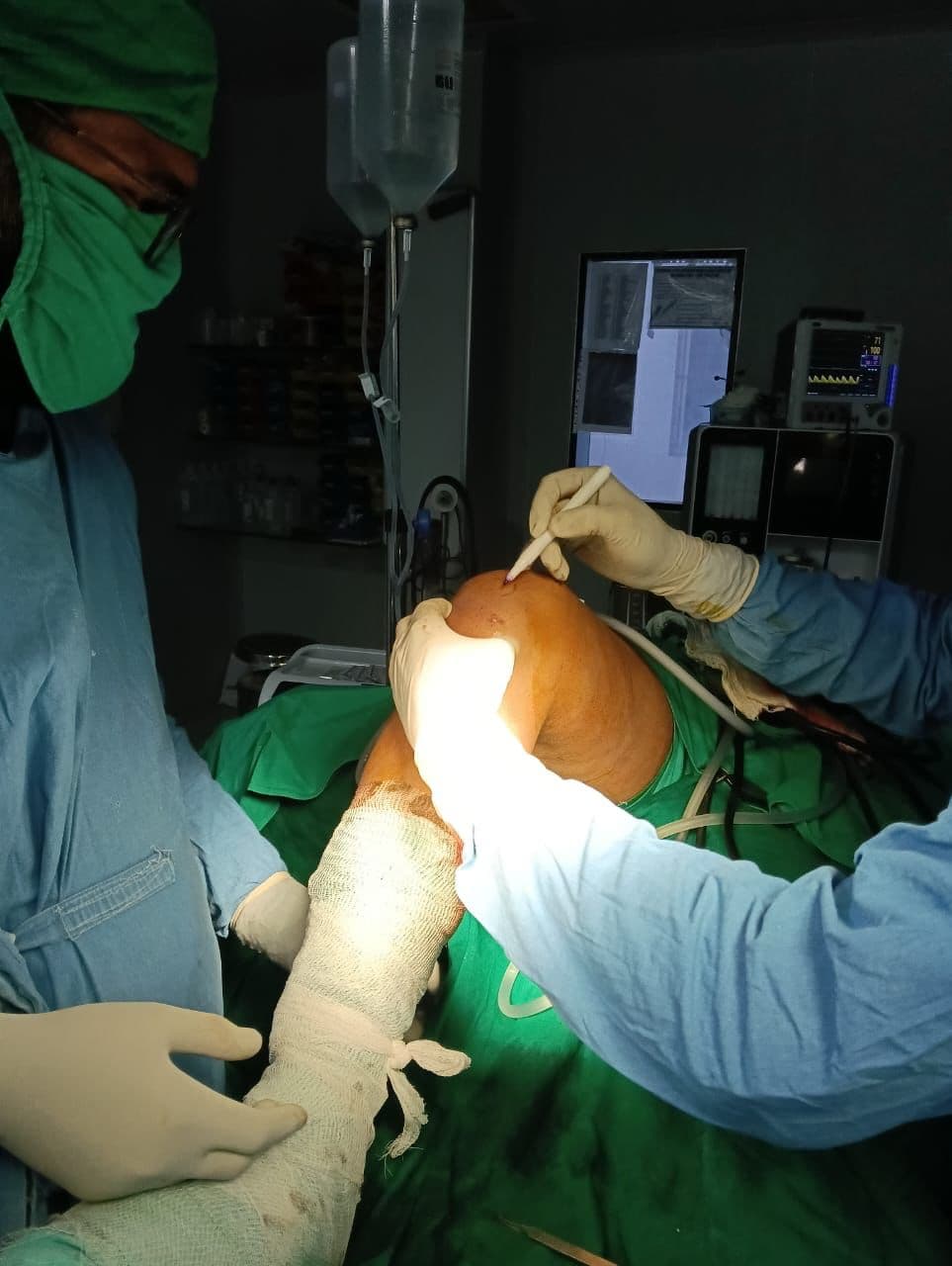 Knee Arthroscopy